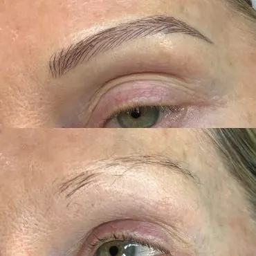 Cosmetic Tattoo Sydney