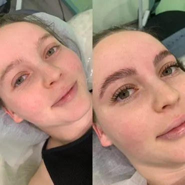 Eyebrow Lamination Sydney